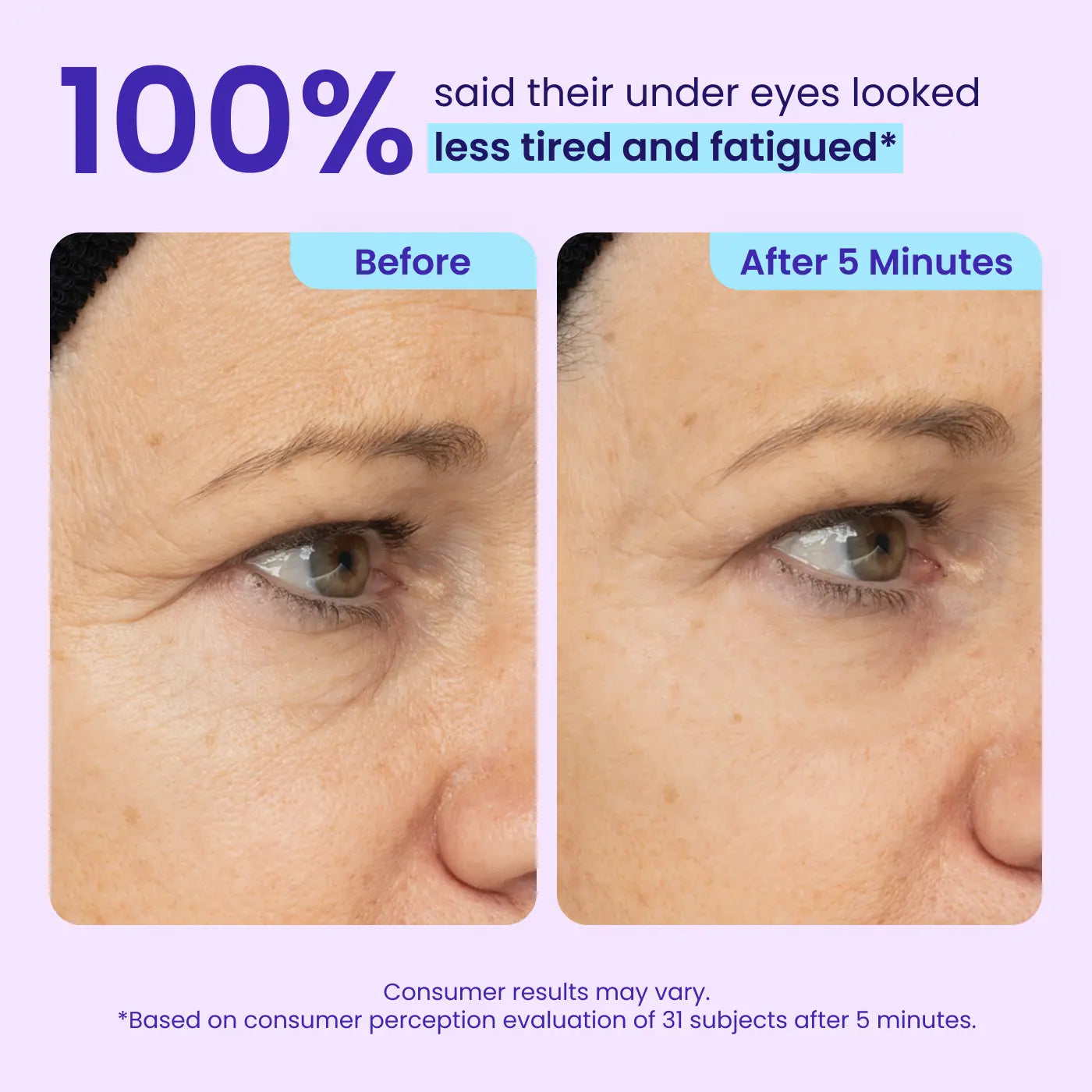 NEW! Instant Lift Eye Gel