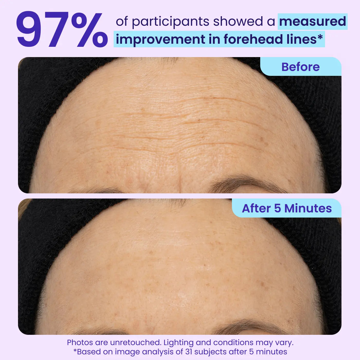 NEW! Instant Lift Eye Gel